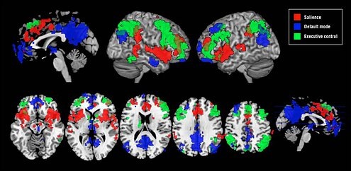 Нейрофизиология гипноза | Рассохин Дмитрий Александрович