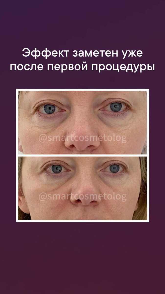  и 