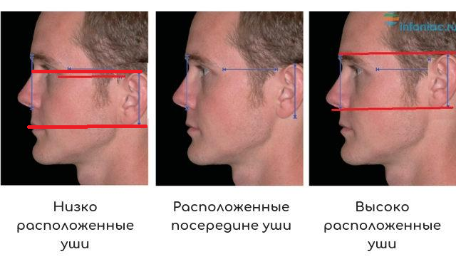 Фото 2. Уши у человека могут располагаться на разной высоте. На левом фото они расположены низко - так что верхний край уха проходит на уровне глаз, а нижний - на уровне рта. А на правом фото уши расположены высоко - так что верхний край уха проходит выше бровей, а нижний - на уровне носа.       