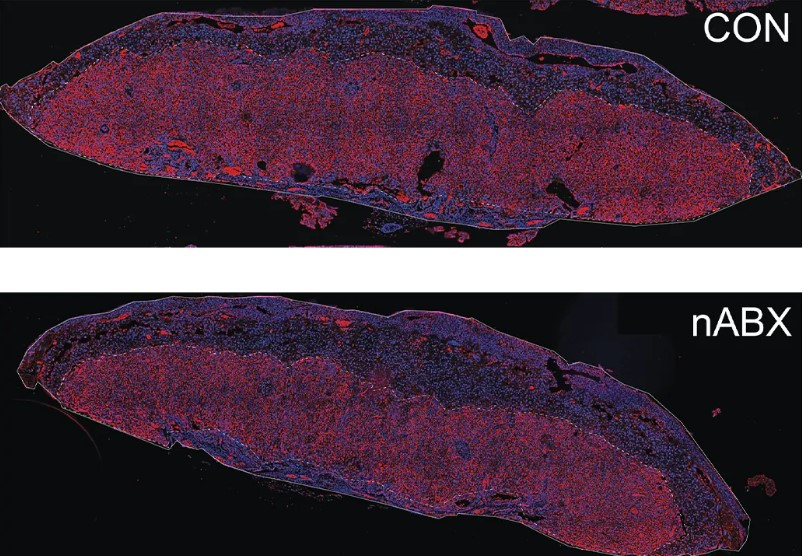 Лабиринтная зона плаценты (красная) уменьшена у плодов от отцов-дисбиотиков (внизу) по сравнению со здоровыми отцами (вверху). Фото: Ayele Argaw-Denboba
