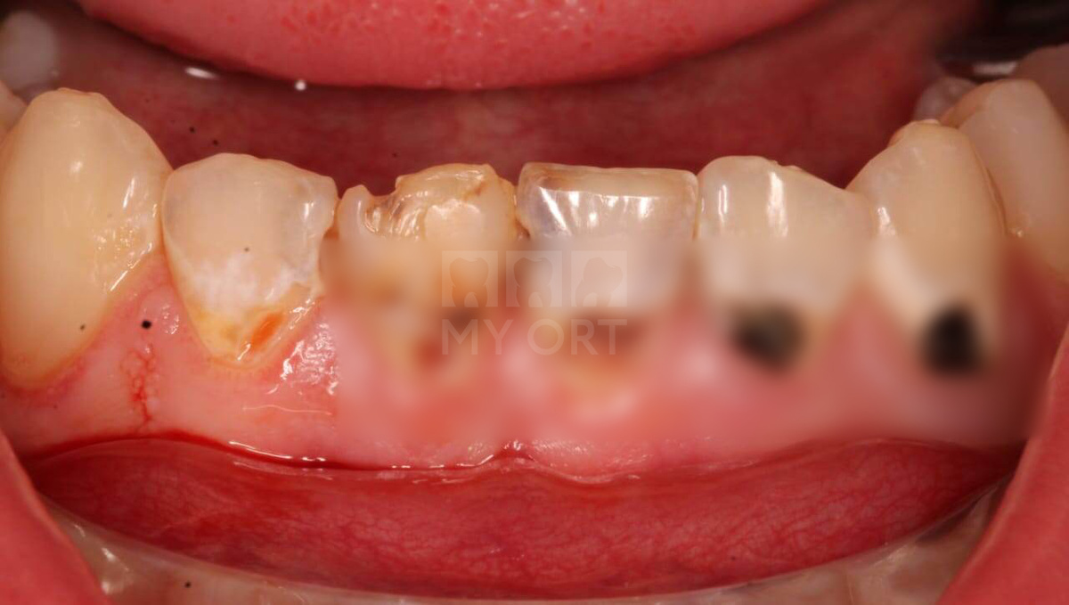 Ситуация ДО