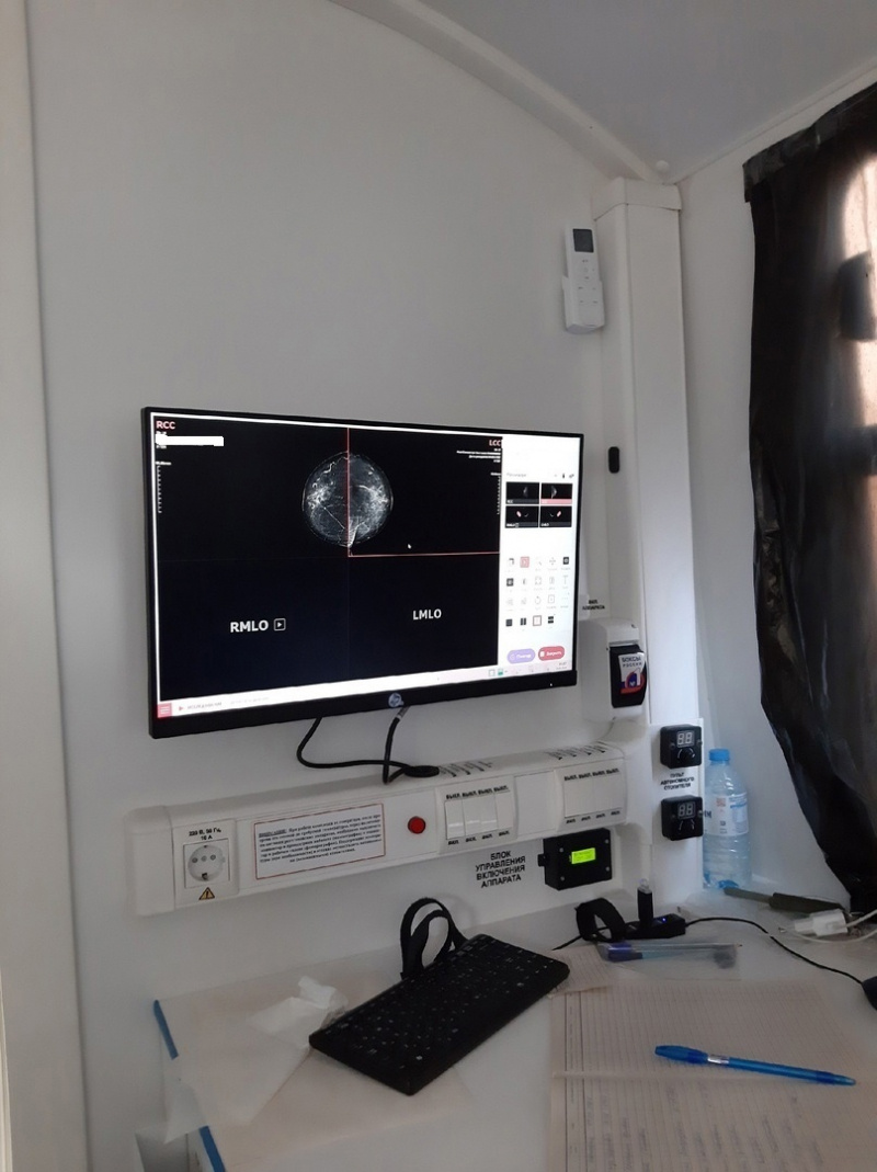    Минздрав Карелии закупает аппараты для диагностики рака грудиМихаил Охлопков / ВК