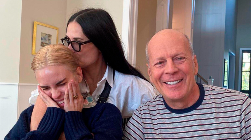    Фото: www.globallookpress.com/face to face