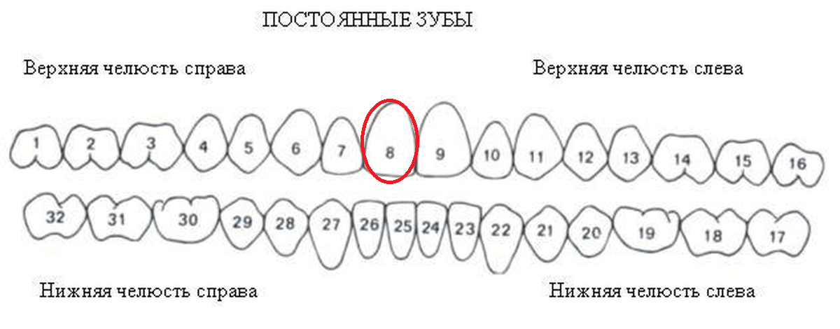 Фото 2. Металлический зуб у Гены находился на самом видном месте - это "восьмерка", правый передний резец.  