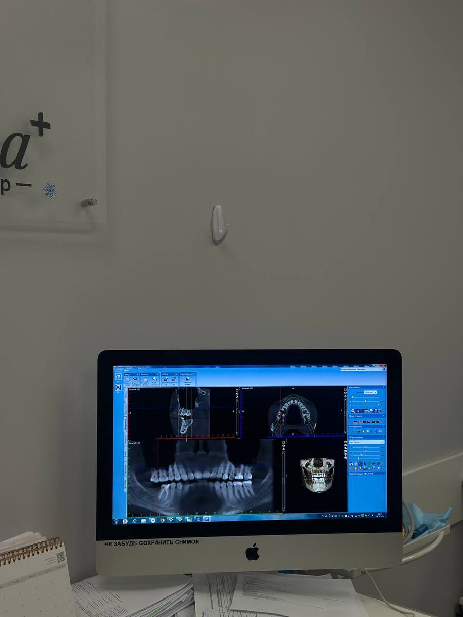 Снимок компьютерной томографии в нескольких проекциях