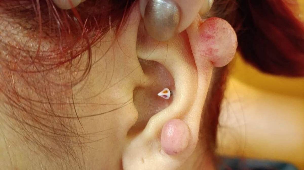    Фото: пресс-служба Минздрава Московской области