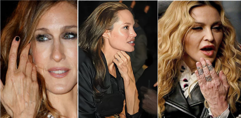 Сара Джессика Паркер, Анджелина Джоли, Мадонна. Вот такие кисти рук обещает улучшить липофилинг.