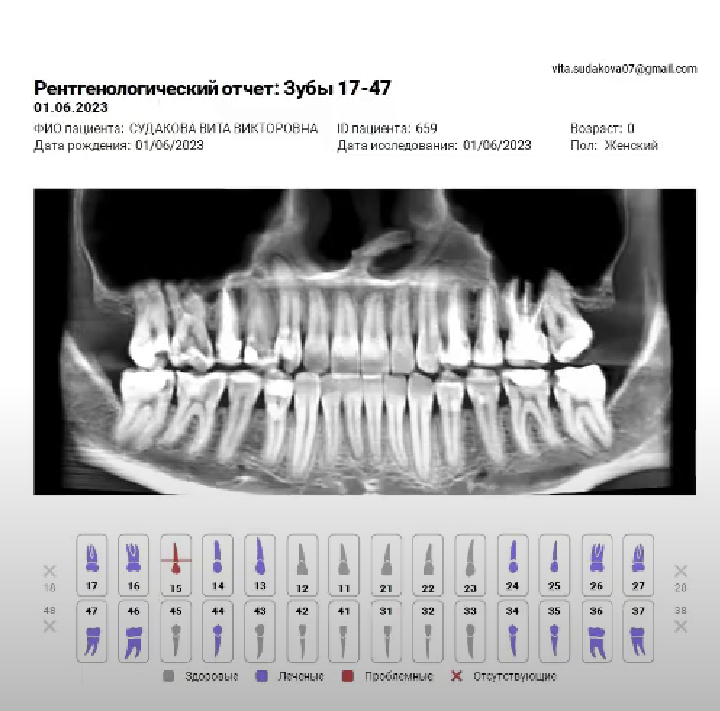 Так выглядит рентгенологический отчет, созданный в программе Диагнокат 