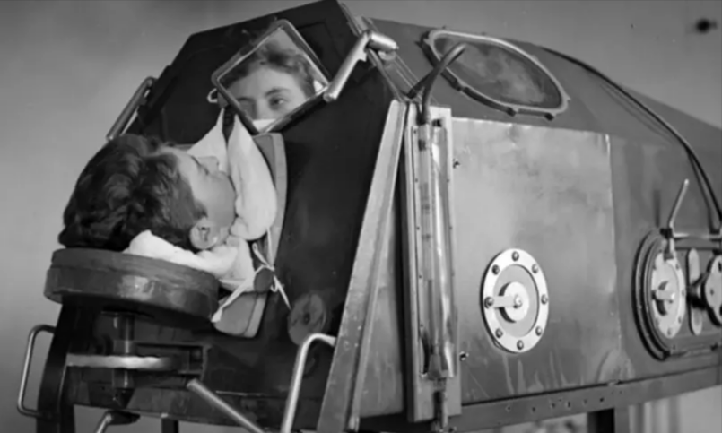 «Железное лёгкое» поддерживает жизнь в людях, переболевших полиомиелитом