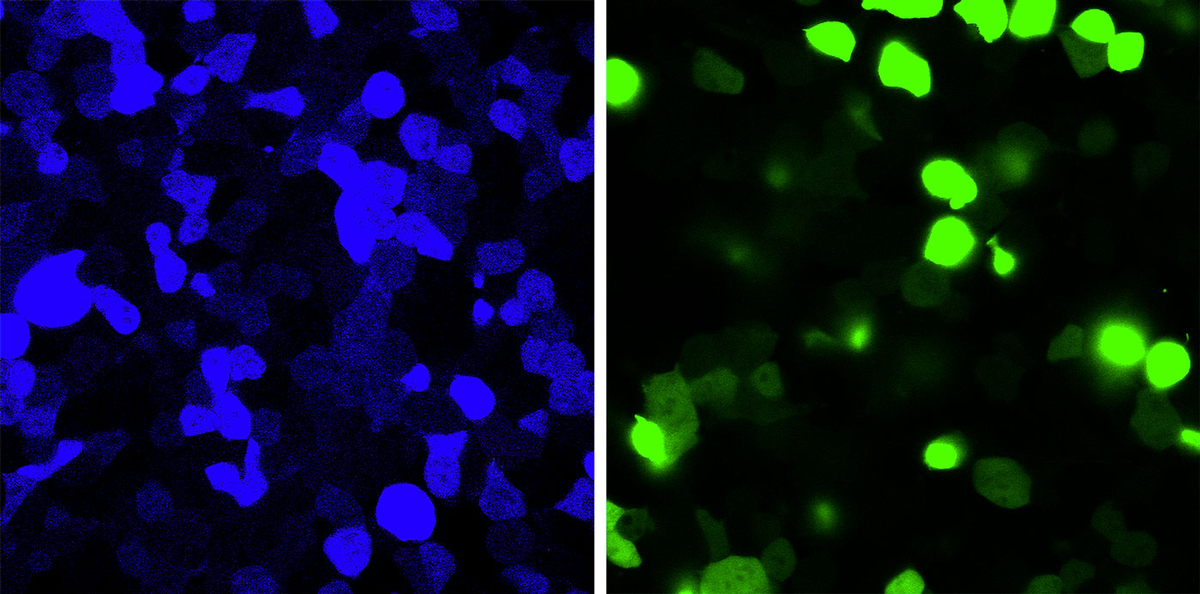 В эксперименте на клетках мутация превратила обычно зеленый флуоресцентный белок в синий (слева). Редактирование мессенджерной РНК восстанавливает нормальный цвет (справа). Фото: Toshifumi Tsukahara/Japan advanced institute of science and technology