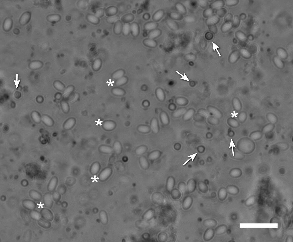 Споры микроспоридии Nosema bombycis (звездочки) и частицы вируса Dscp-1 (стрелки) в гусенице сибирского шелкопряда. Источник: Rumiantseva et al. Journal of Invertebrate Pathology, 2024