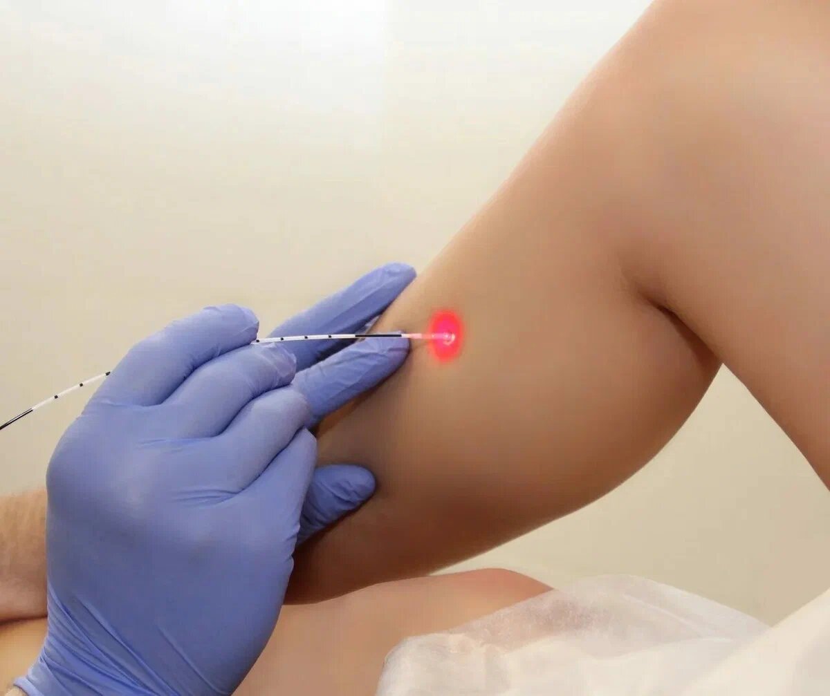 Сегодня востребованы малоинвазивные оперативные вмешательства