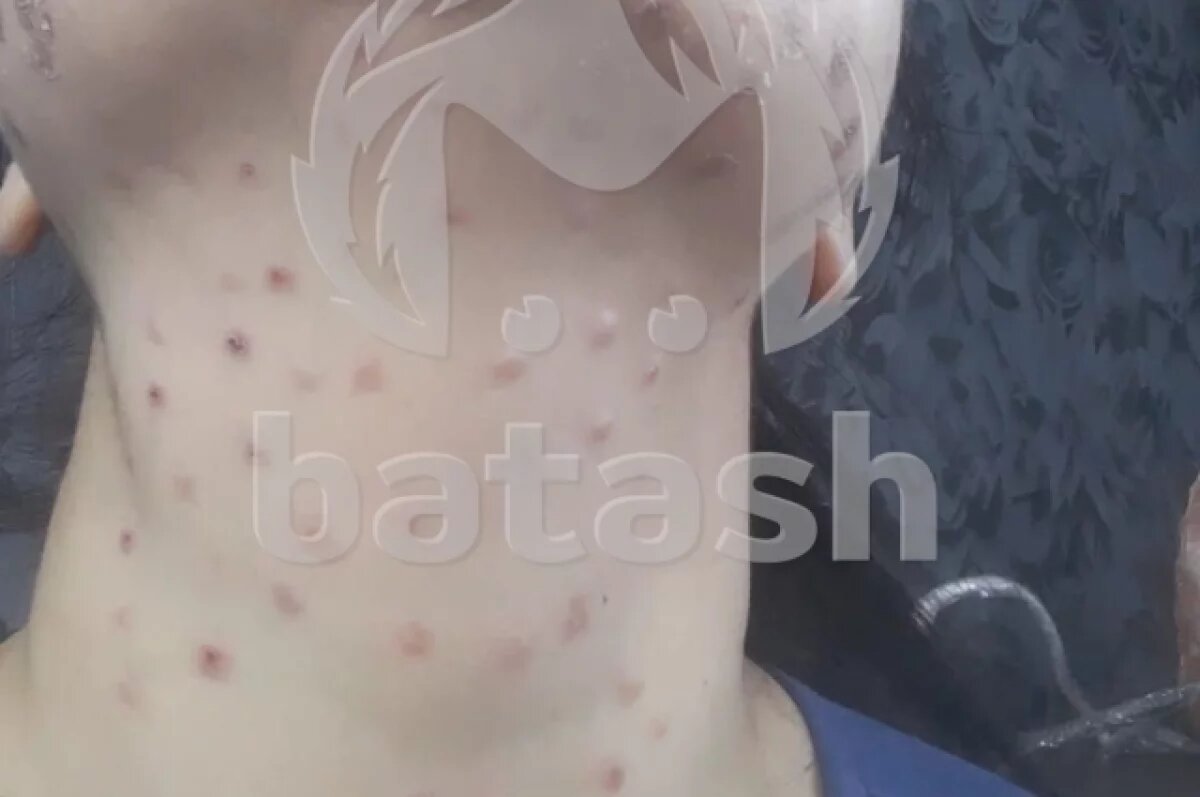    Следователи проверяют косметологию, которая изувечила жительницу Уфы