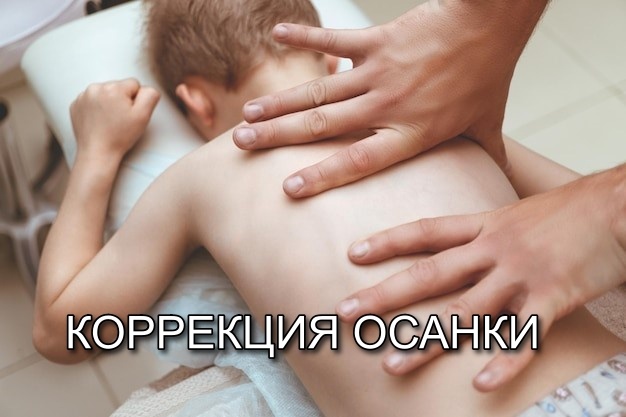 Коррекция осанки у детей