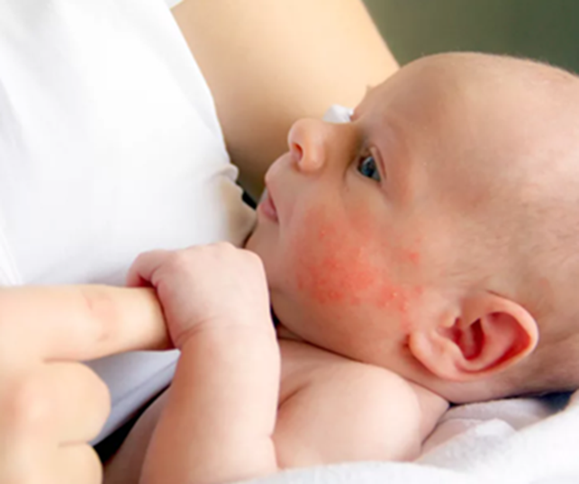 Фото с броздоров интернета