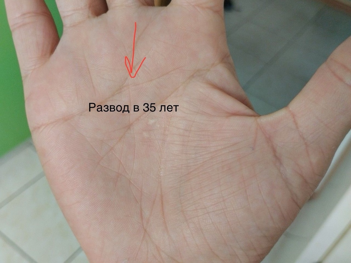 Пример развода на руке