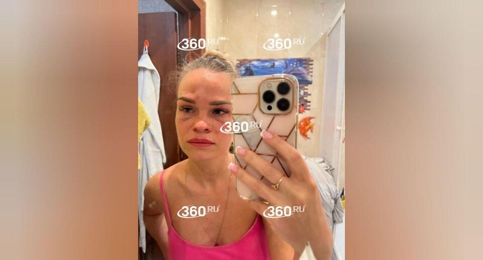    Телеканал «360»