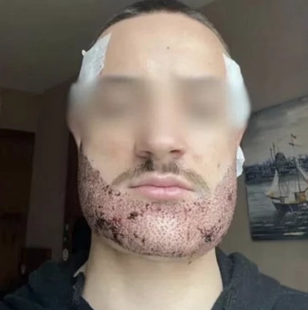    Матье Вижье Латур. Фото: соцсети