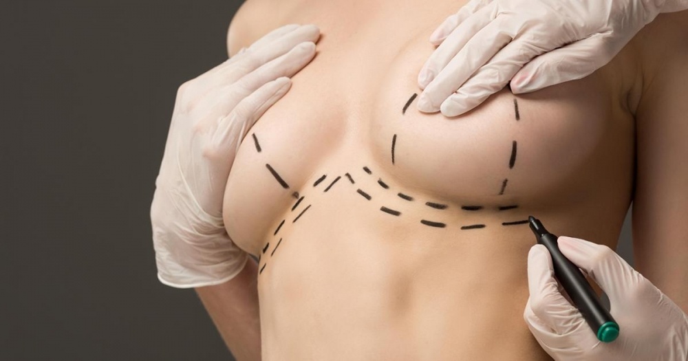 Маммопластика – желанная для абсолютного большинства женщин операция, потому как грудь наиболее уязвимая часть тела по отношению к различным факторам и обстоятельствам. Гормональный фон, изменения веса, роды, лактация корректируют со знаком минус молочные железы.