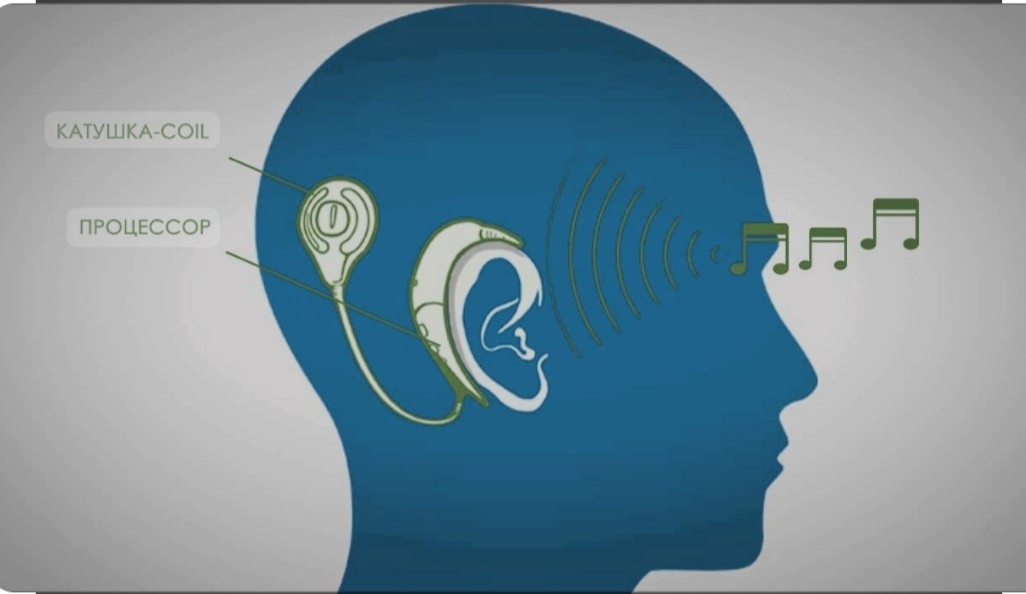 Заболевания органа слуха.