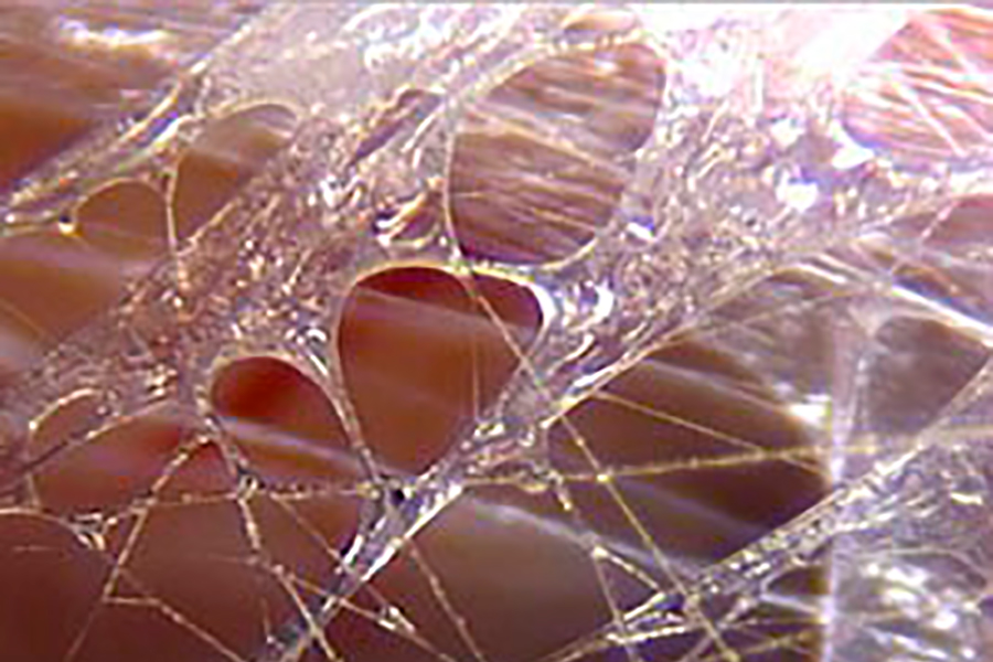 Фасция под микроскопом. Вода словно «бусинки» нанизана на структуры соединительной ткани. Недостаток воды приводит к тому, что фасция становится сухой