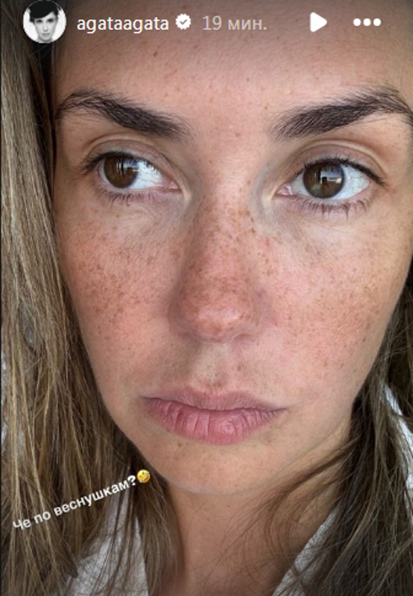 Агата Муцениеце похвасталась веснушками. Фото: соцсети
