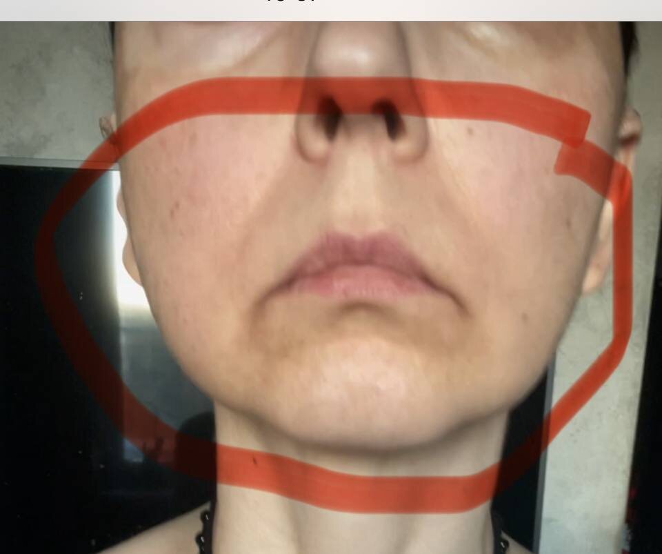 Вот они - беспокоющие меня места. на этом месте морщин у меня быть не может. А вот брыли есть.