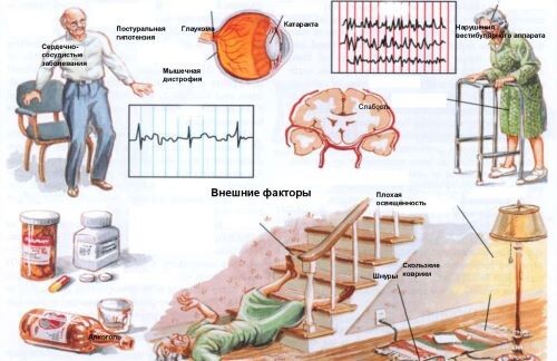 Чтобы избежать падений, нужно постараться не допустить развития имеющихся заболеваний и лечить первопричину