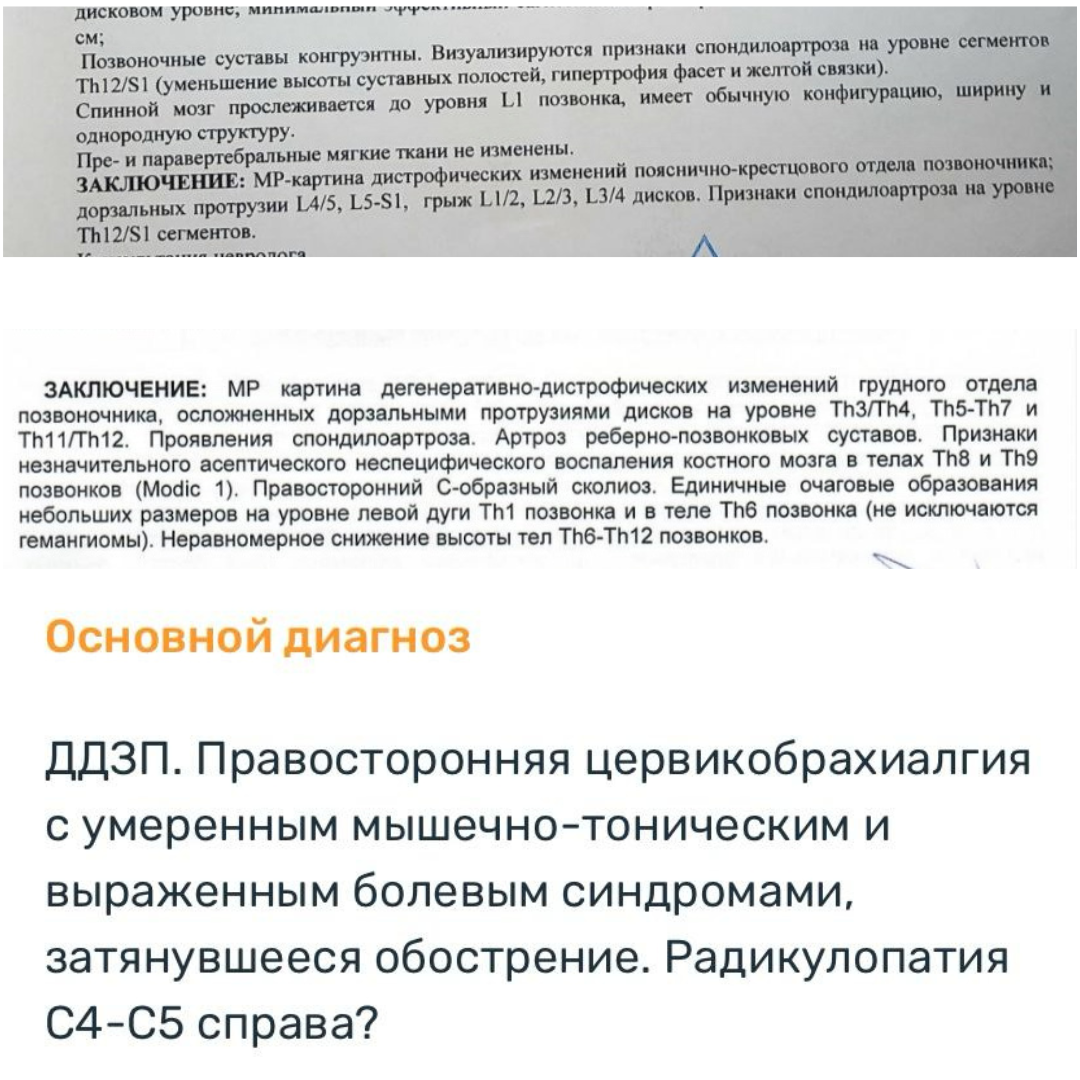 Результаты МРТ-исследований