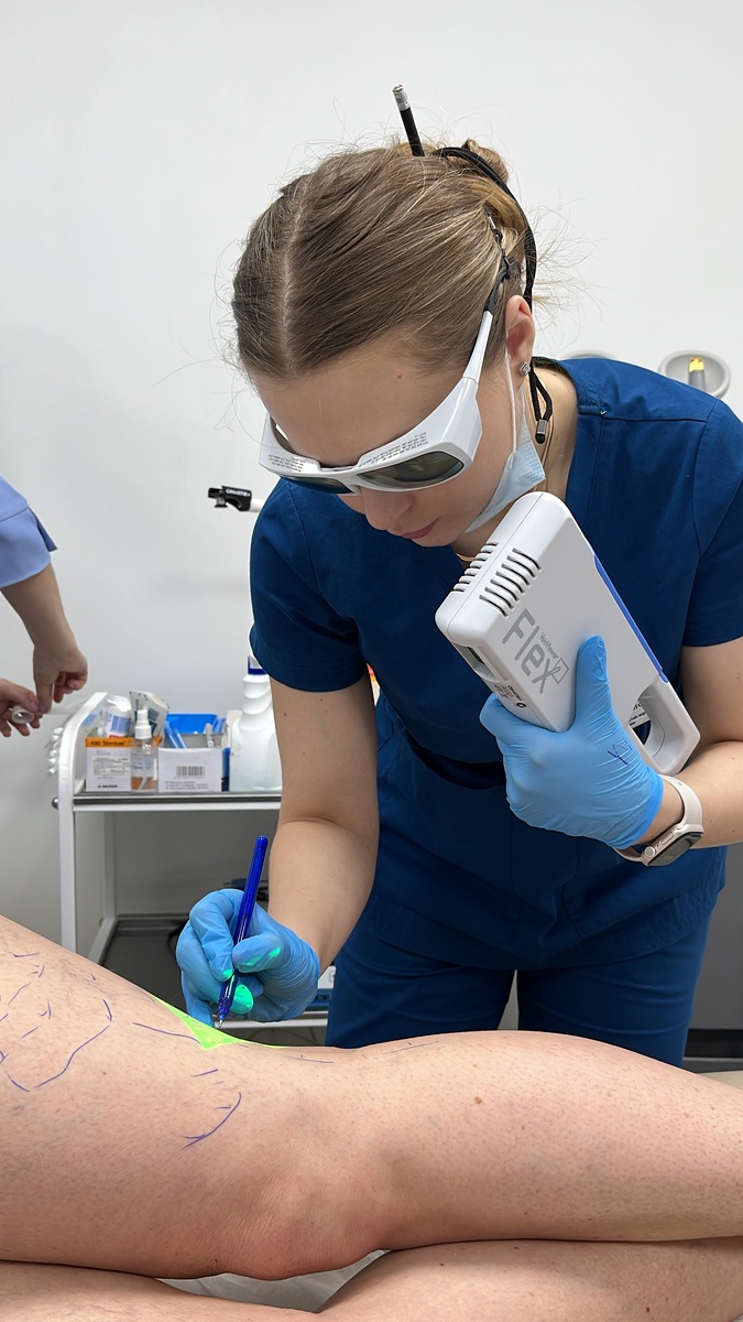 Одна из флебологических процедур, проводимая мной