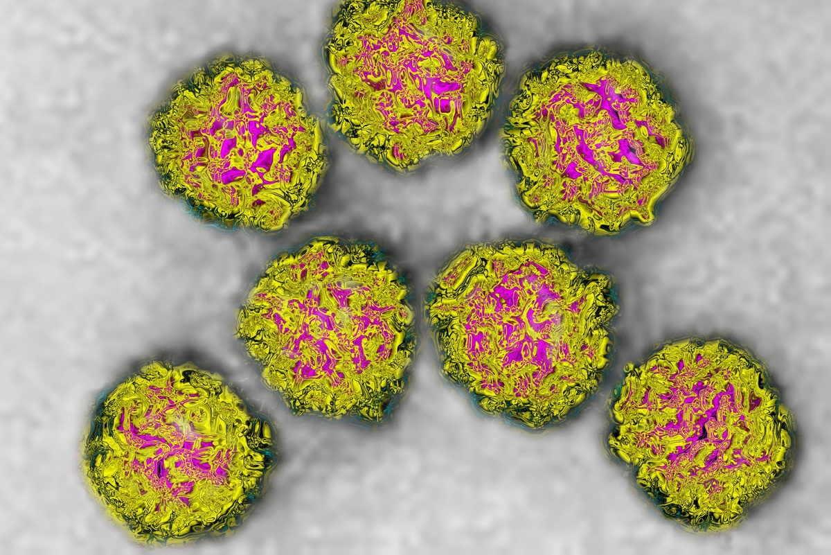  📷 📷 📷   Как выглядит вирус Коксаки