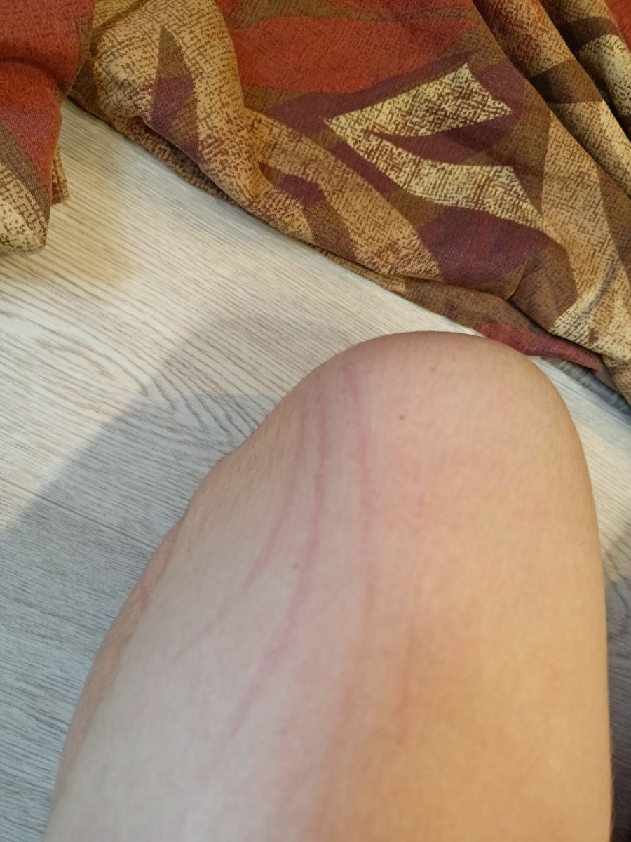 вот что бывает, если пытаться посадить Банникулу туда, куда ей не хочется 