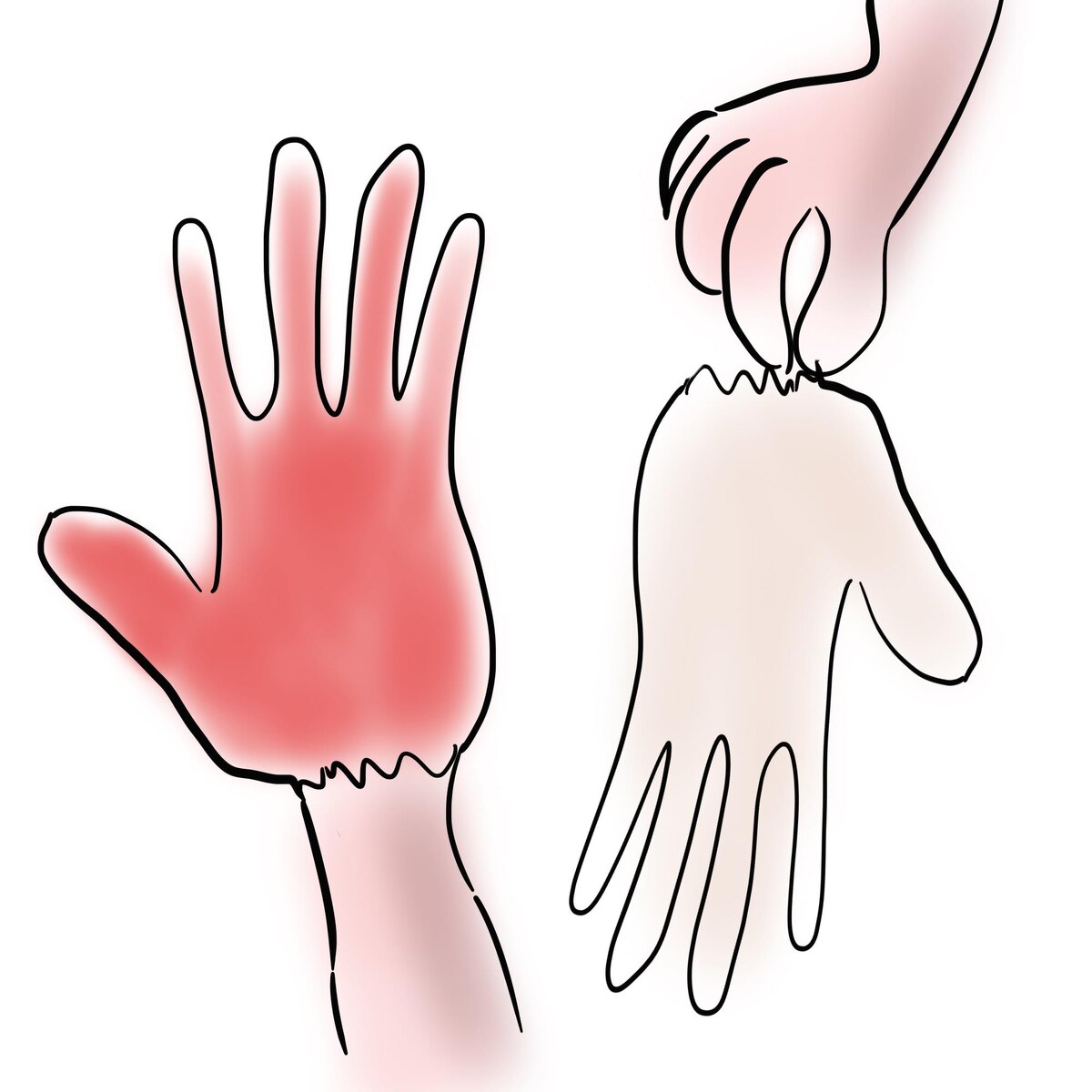 Пальцы облезли