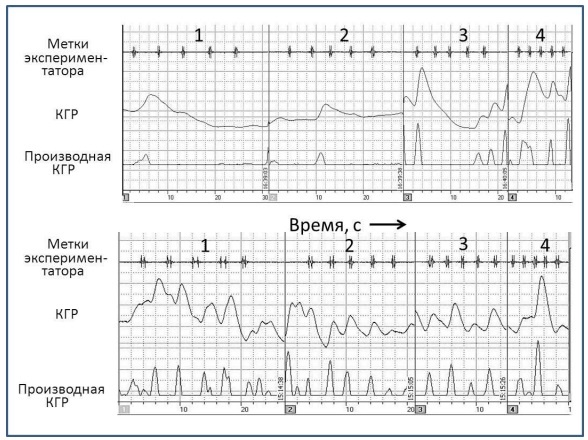 Рис.1. Примеры обработанных записей динамики КГР во время движения ассистента по кругам 1-4 разного диаметра (от наибольшего к наименьшему). График вверху — спокойная испытуемая, внизу — неспокойная