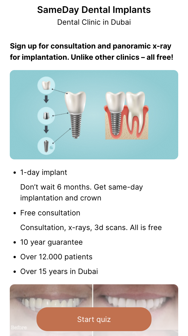 Квиз с landing page  