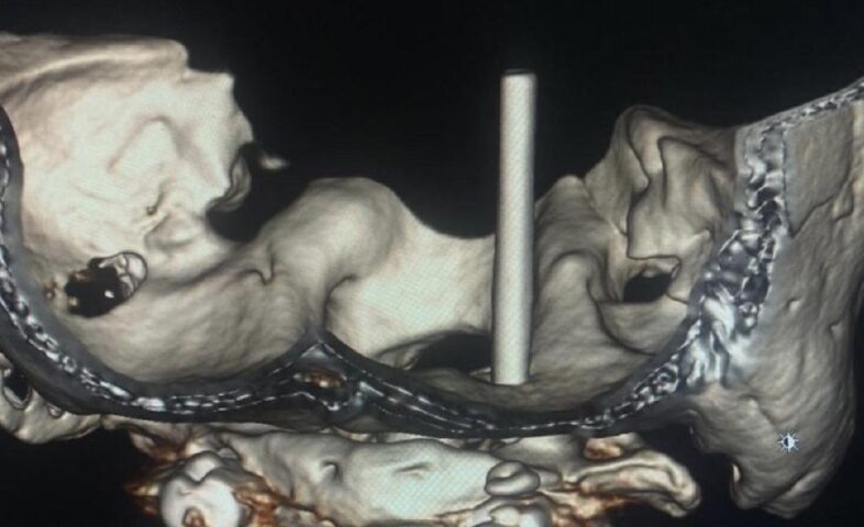    Фото t.me/kkb2krasnodar