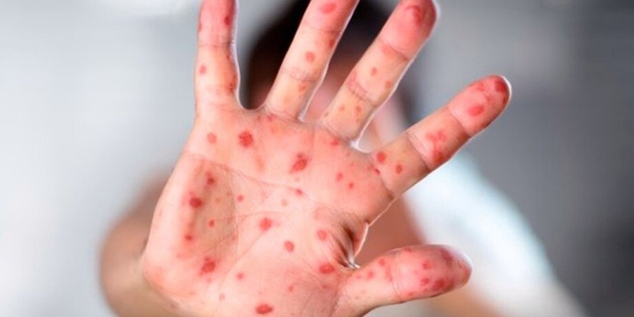 Фото: depositphotos/rfphoto 