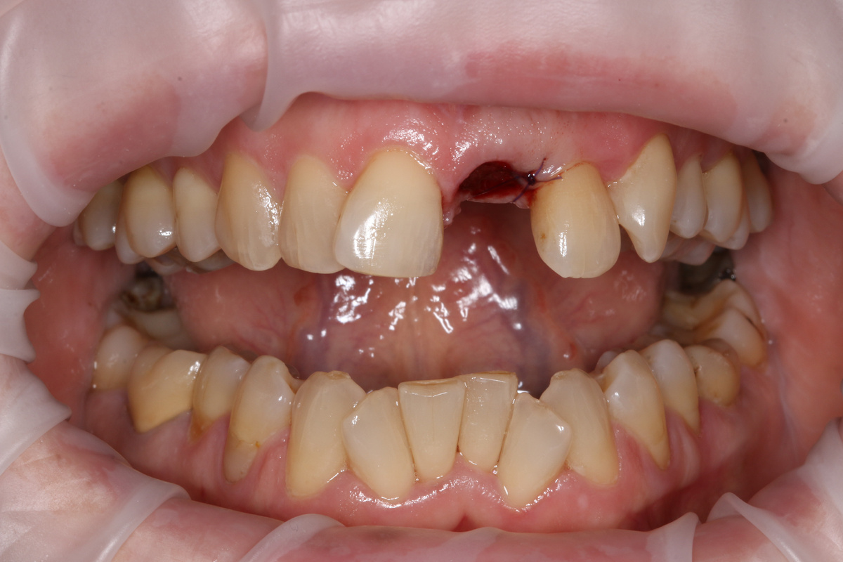 А вот так выглядела бы улыбка без каппы