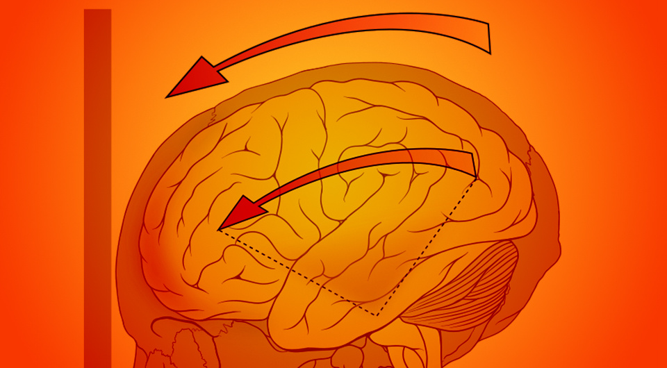   N + 1; Patrick J. Lynch / Wikimedia Commons / CC-BY-2.5