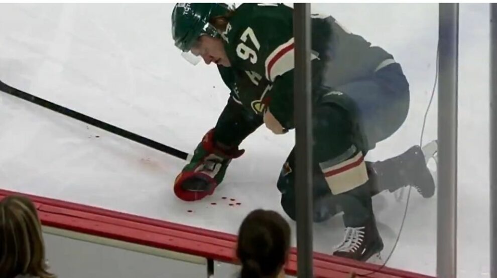    Капризов получил травму, фото снимок экрана