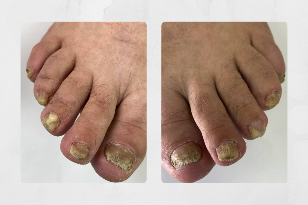 Первый визит состоялся 21 апреля