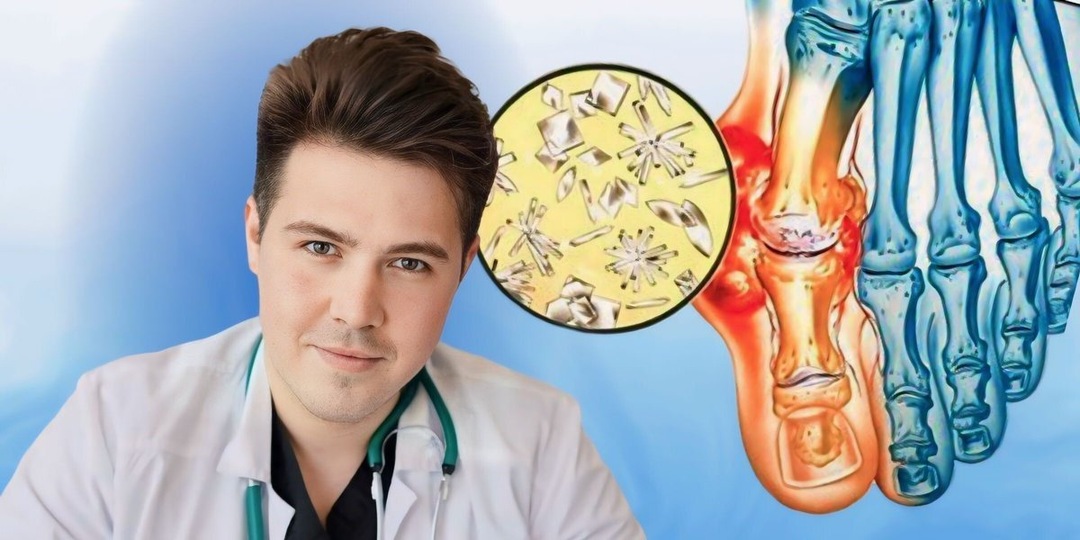 Мочевая кислота вредит суставам: от боли в большом пальце до нефролитиаза. Как распознать болезнь на ранних стадиях