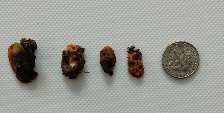    Самый злокозненный патоген сои назвали ученые