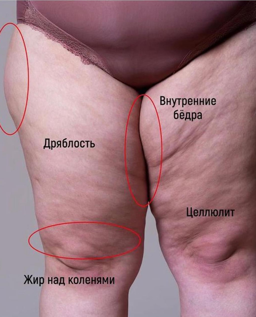 Только комплексный подход действенен! 