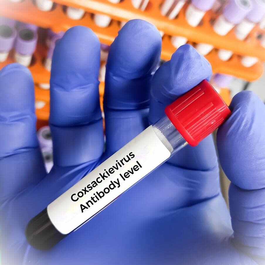    Вирус Коксаки – частое явление для лета и осени. Copyright (c) 2024 Babul Hosen / Shutterstock