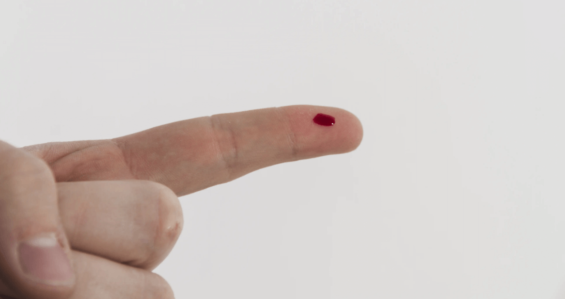    Порезы бумагой всегда сильно болят, и этому есть несколько причин. Источник фото: information-dentaire.fr