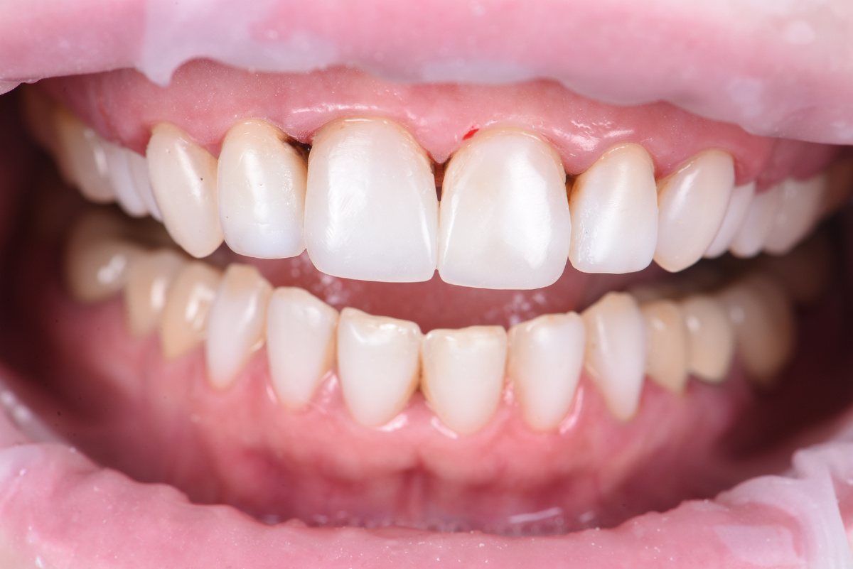 Отреставрированные «единички» 