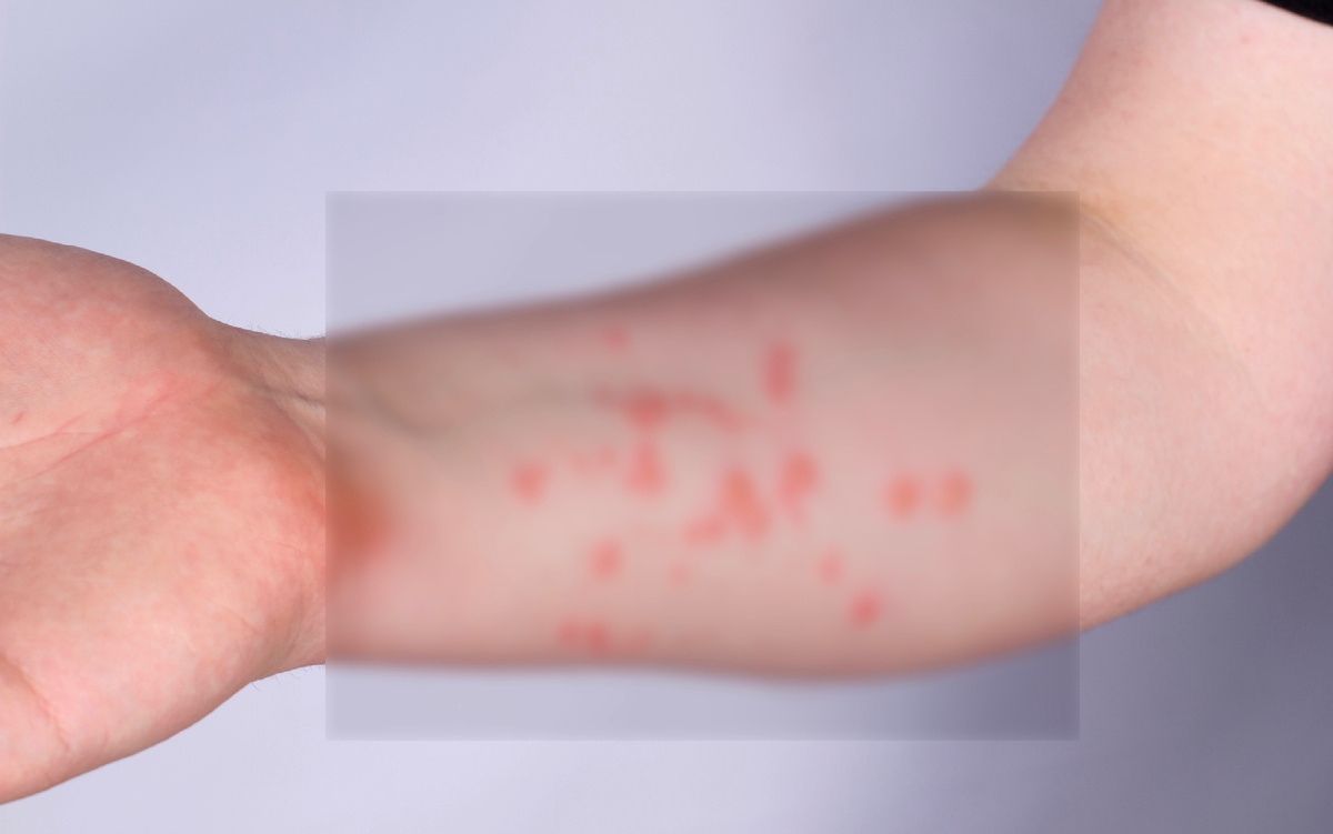 Фото взято из открытых источников 