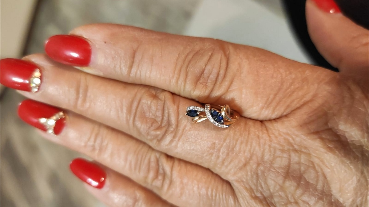 Вот такая красота выпала с уха