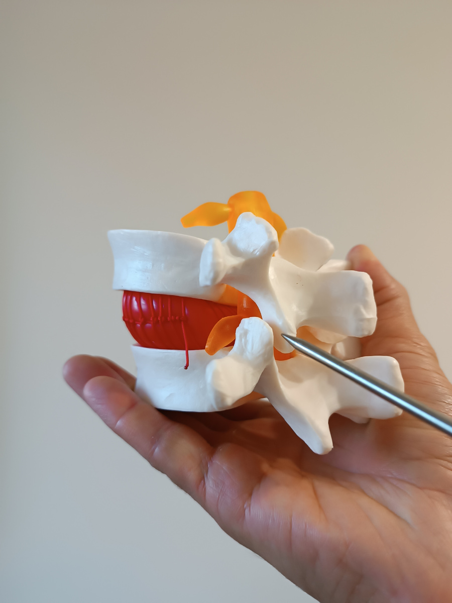 Фасеточный сустав